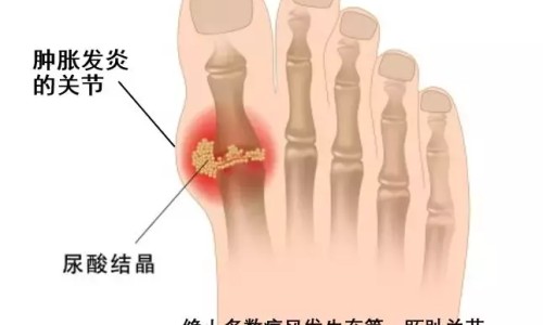 怀疑有胸腰椎骨折的病人搬运时可采用2人抬-怀疑有胸腰椎骨折的病人网怀疑有胸腰椎骨折的病人怎么搬运知识网站,分享腰胸椎压缩性骨折会恢复好吗大全